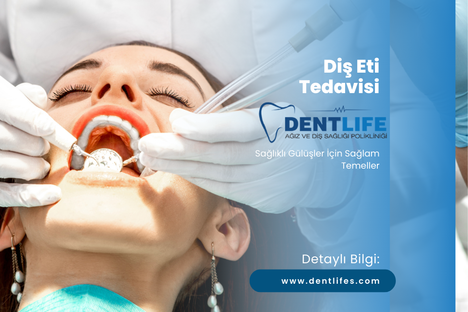 Diş Eti Tedavisi - Sağlıklı Gülüşler İçin Sağlam Temeller